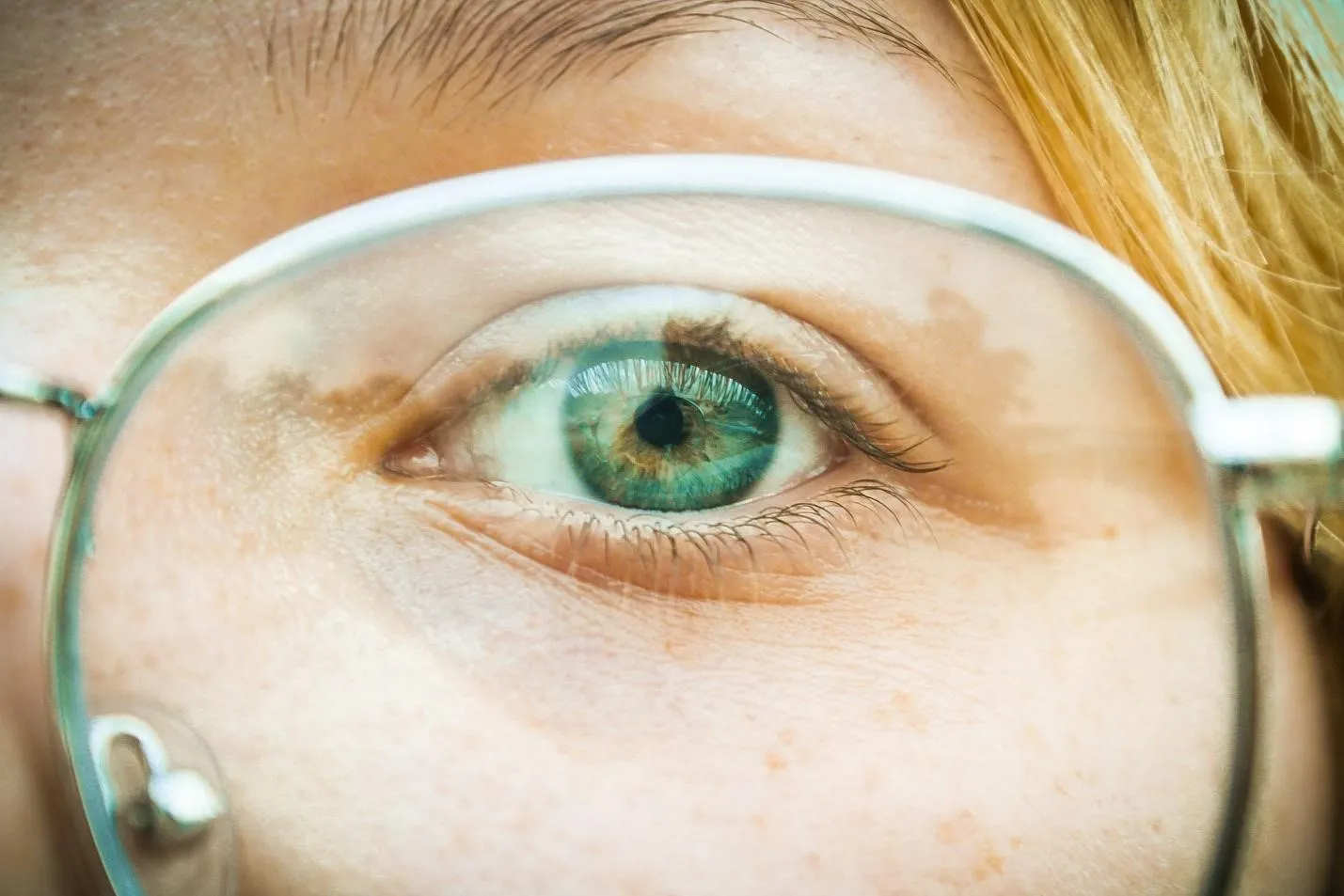 What Is the Difference Between PRK and LASIK Surgery?