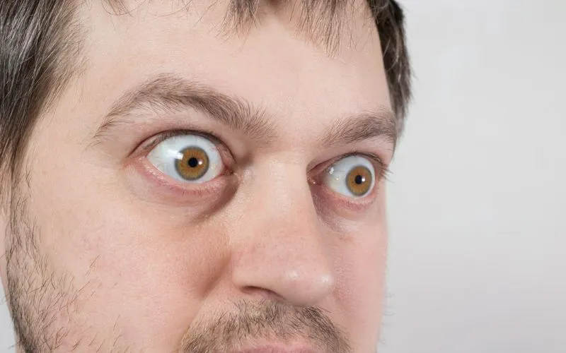 Can You Reverse Thyroid Eye Disease?